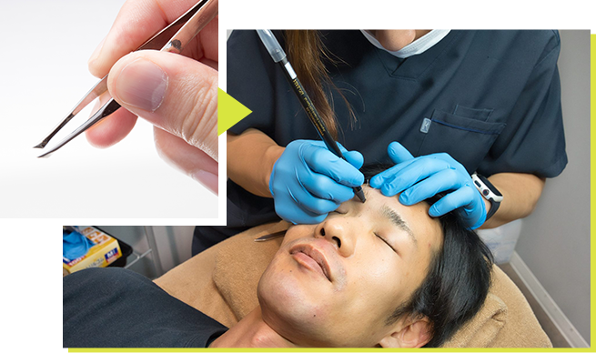 理由3：針の痛みはほぼありません