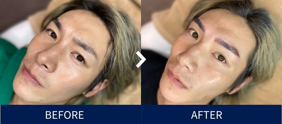 BEFORE/AFTER